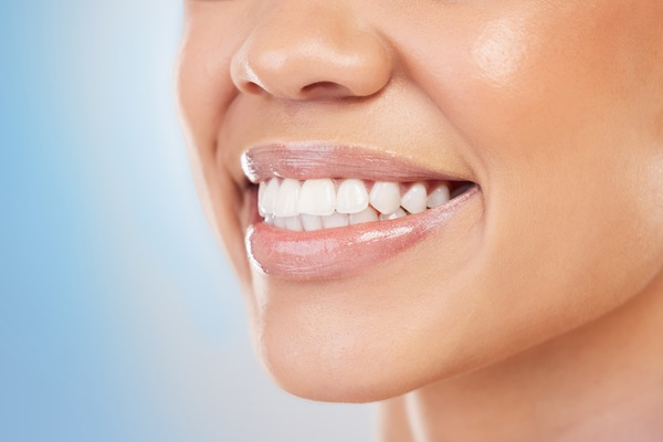 Can Dental Bonding Fix My Smile?