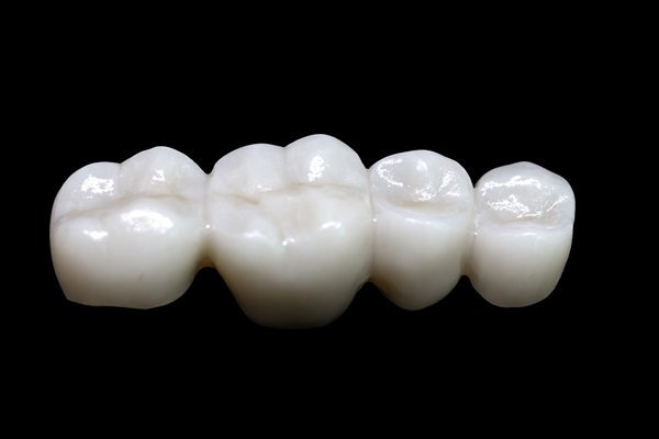 Does A Restorative Dentist Use Dental Bridges?